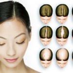 The Thin Hair Line