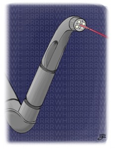 Laser