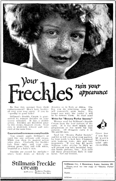 1929_Freckles